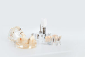 Produktbild Implantate Implantage / Fotograf*in: ElsnerFotografie - Jessica Elsner